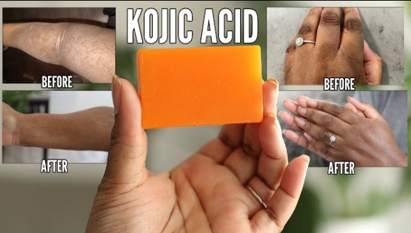 كيفية استخدام صابون حمض الكوجيك ما يجب أن تعرفه